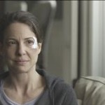 concussion