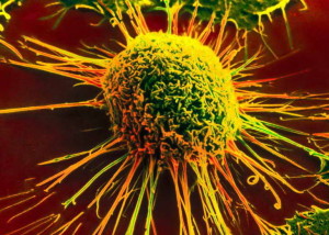 18_cancer_cell